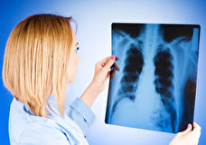 В регионе снизилась заболеваемость туберкулёзом