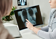 Диагностика начинается с пациента: рентгенолог рассказал об эффективных методах выявления рака