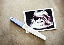 Гинеколог рассказала, кому подходит ЭКО и какие реальные шансы процедура дает на рождение ребенка