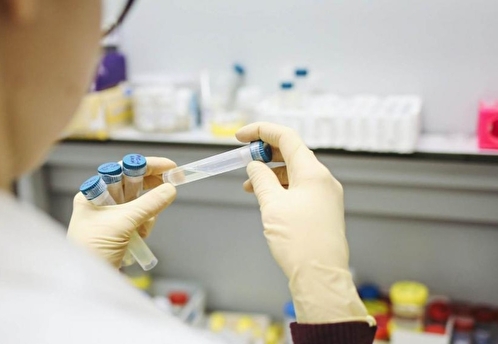 Ученые из Китая и Сингапура выявили новый вид генипавируса у 35 человек
