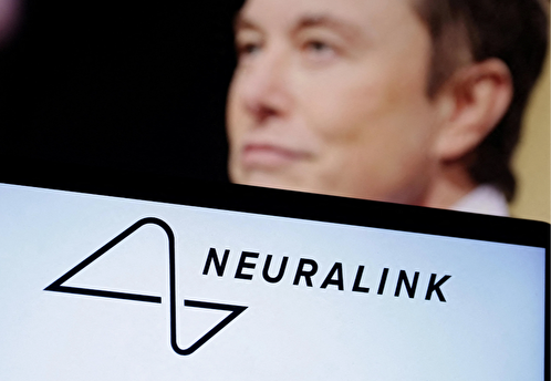 Человек с имплантом Neuralink рассказал, что пользуется им почти весь день