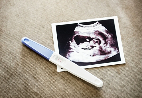 Гинеколог рассказала, кому подходит ЭКО и какие реальные шансы процедура дает на рождение ребенка