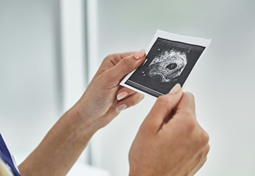 Эксперт рассказала о важности вакцинации против ВПЧ